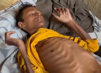 रोगले थलिएका १९ वर्षे विजय : उपचार नपाएर ओछ्यानमै सुक्दै छ शरीर